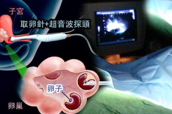 上海助孕中介-上海三代试管医院