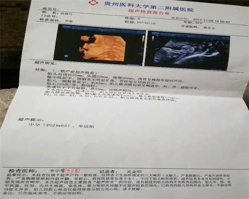 上海私人代孕联系号码_上海代孕微信交流群_金宝贝环球宝贝课程-造影可以治疗