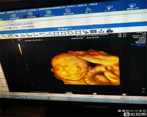 上海找一个代孕_上海代孕的小孩好吗_嘉宝助孕官网-哪里有代孕的女孩_代怀孕