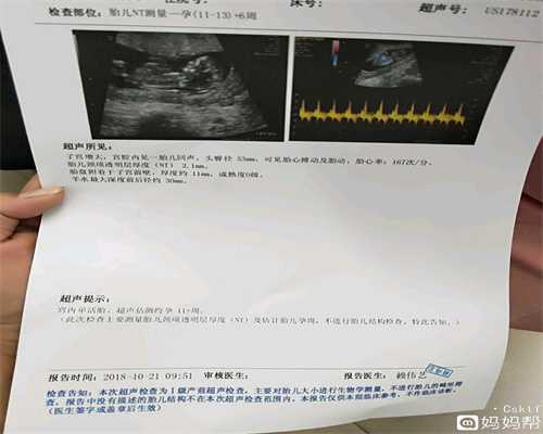 上海有想做代孕的吗_上海代孕成功率在多少_生命天使助孕-宝宝拉稀能吃辅食吗