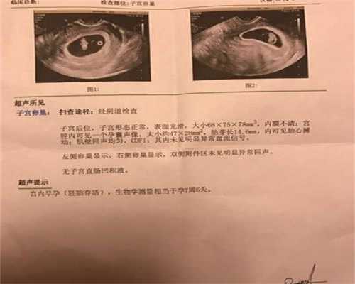 上海可代孕的国家_上海怎么找合适的助孕机构_天津爱维医院正规吗-精子畸形疾