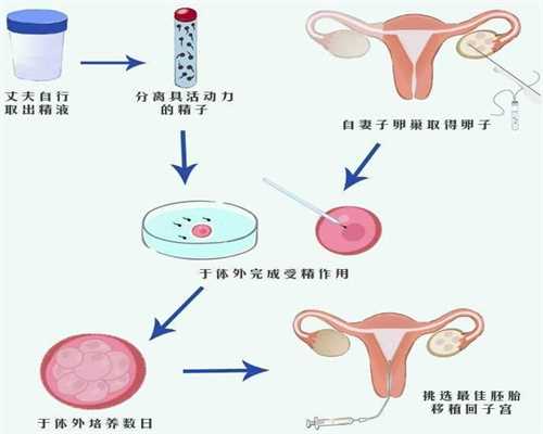 上海可以单身代孕吗_上海找代孕有哪些后遗症_上海高鹰助孕网址-女性不孕症的