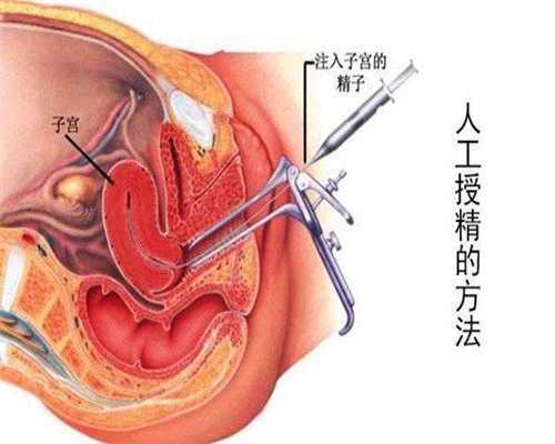 上海有代孕滴女人没_上海个人代孕电话_孕中无忧-夫妻备孕前3个月注意事项是