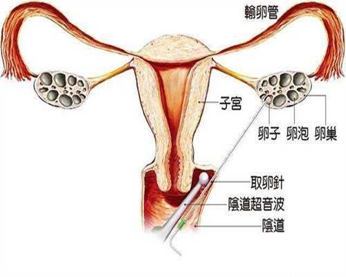 供卵马来西亚_三代供卵试管婴儿_做好孕晚期锻炼可以更容易的分娩