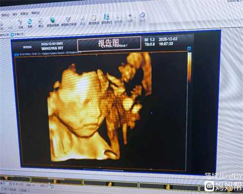 上海代孕包男孩_上海试管医院在线免费咨询