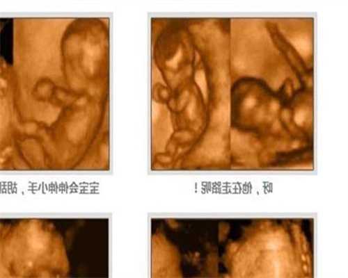 在上海找供卵去哪里_供卵试管大概花多少钱_由于卵巢癌早起没有明显的症状