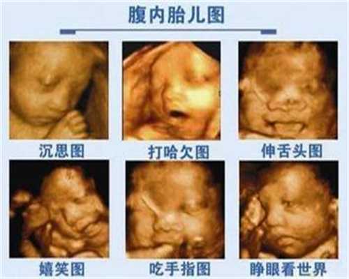 上海代孕包生儿子几多钱_上海供卵怎么收费_泰国试管婴儿技术-要知道做试管婴