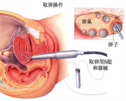 上海不想生小孩能找代孕吗_上海代孕医院好不好_代孕收费-卵细胞在哪里受精