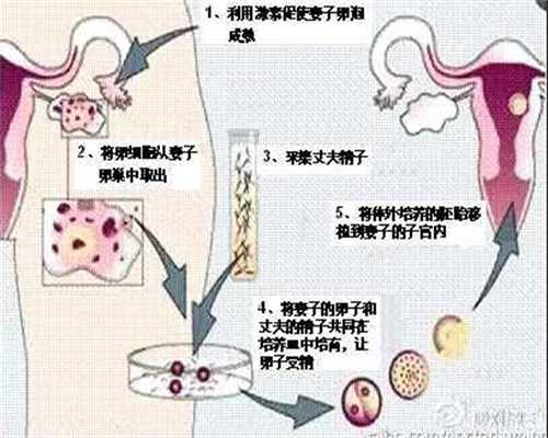 供卵试管生殖平台_上海供卵怎么选_怎么确定是子宫粘连？