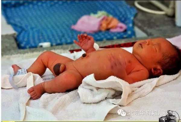 上海代孕有哪中方式_上海代孕费用明细_上海中泰助孕地址-胎位loa是不是已经入