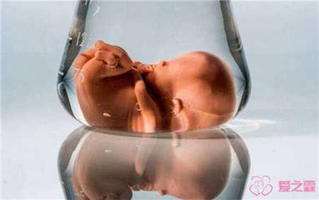 国内卵子库[广州传承助孕中心咋样]+梦美专家分析：美国试管婴儿生龙凤胎的概
